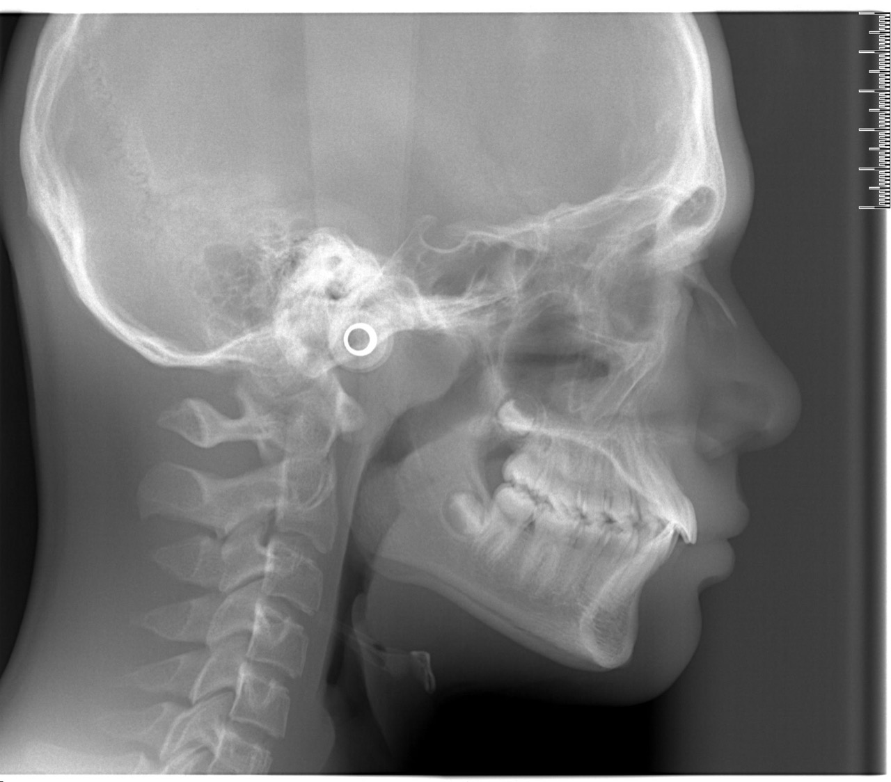 orthodontie - 70
